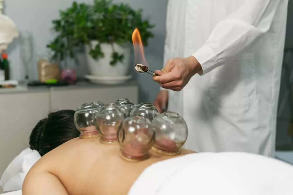 Dry Cupping Therapy in Dubai