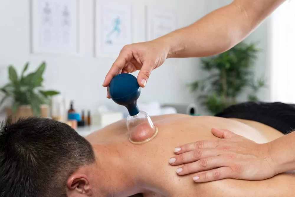 Hijama Cupping Therapy