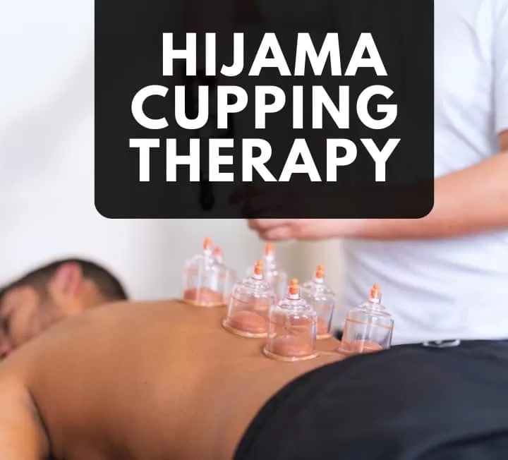 Cupping Therapy