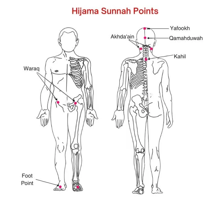 Hijama Sunnah Points