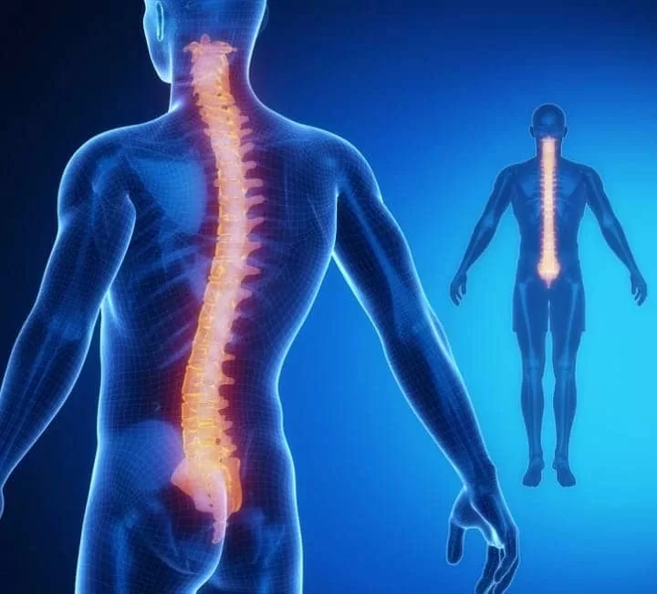 Spine Surgery in Dubai
