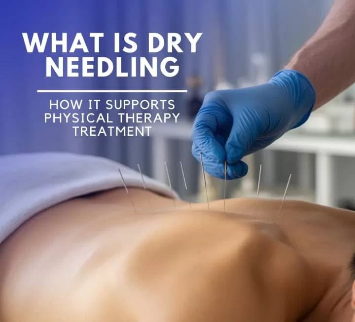 What Is Dry Needling