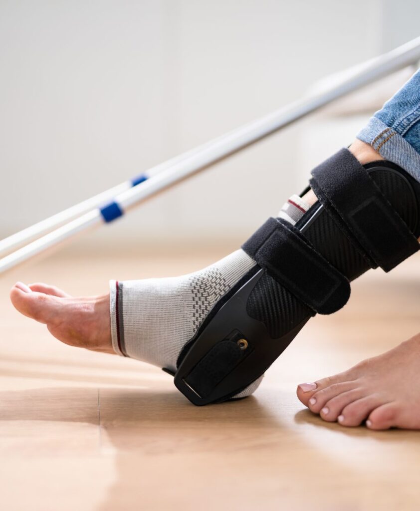 Best Ankle Surgeon Dubai