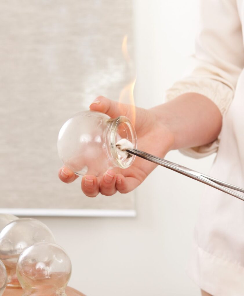 Dry Cupping Therapy in Dubai