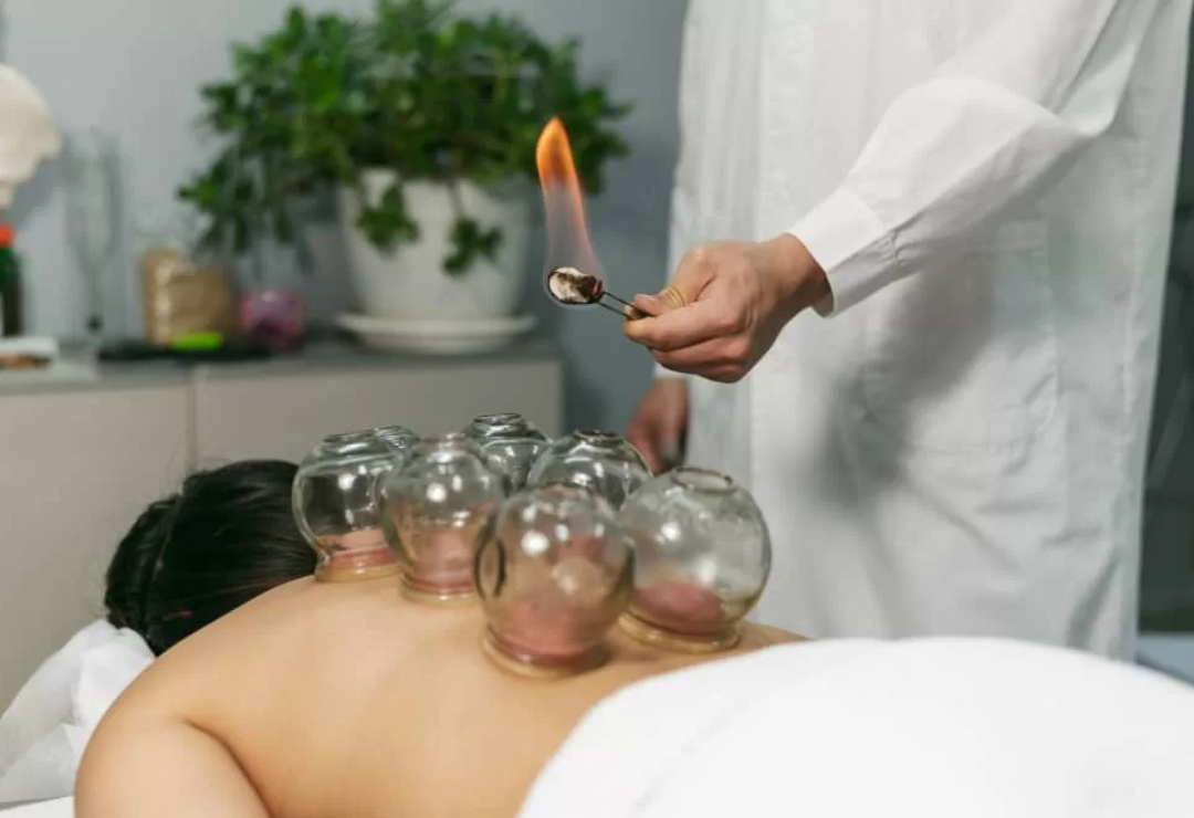 Dry Cupping Therapy in Dubai