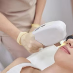 Endolift Laser Treatment