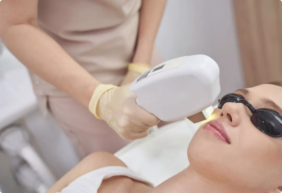 Endolift Laser Treatment
