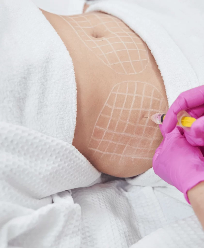 Fat Melting Injection