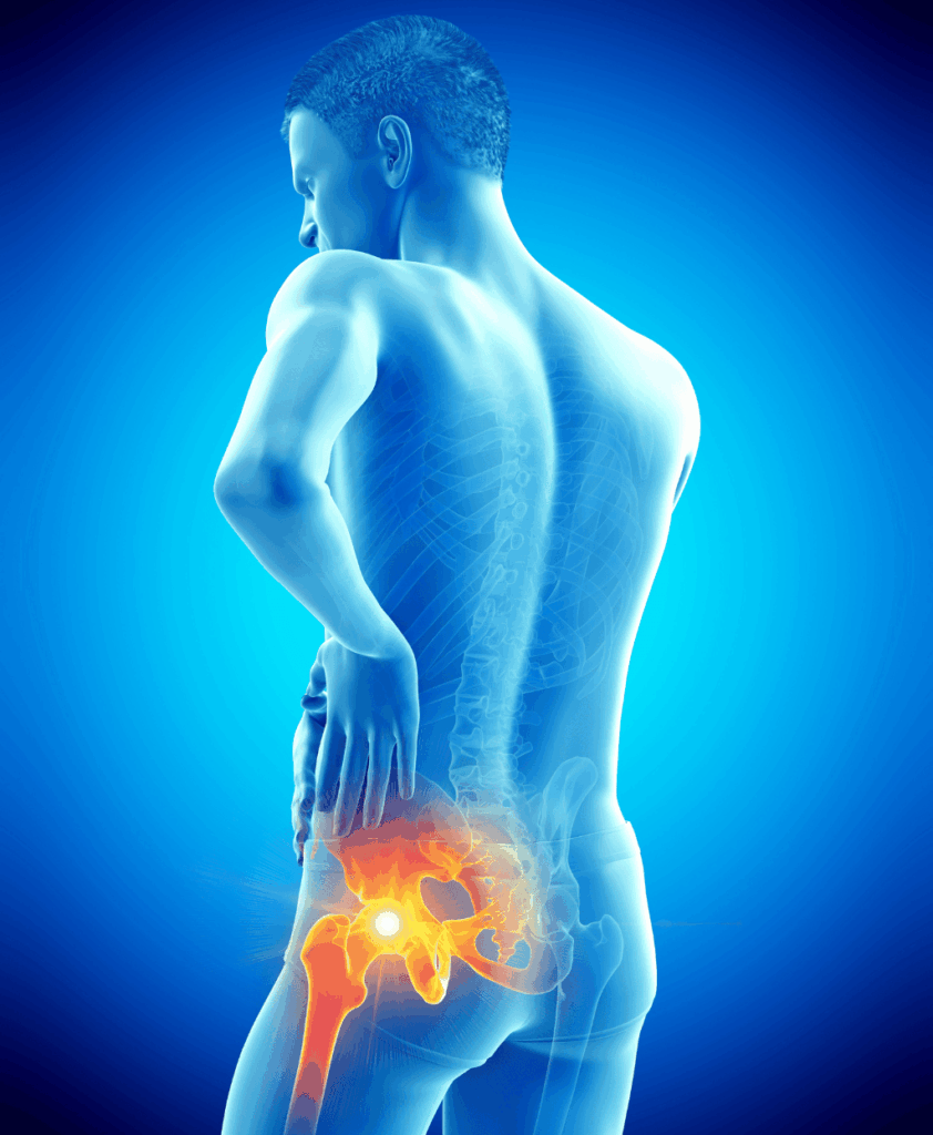 Hip Replacement Surgery Dubai