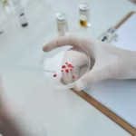How Stem Cell Therapy Works