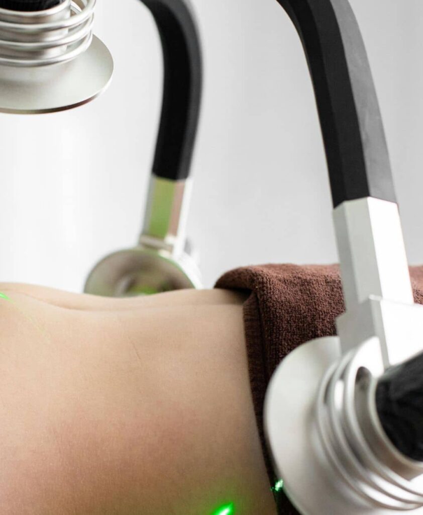 Laser Liposuction Dubai