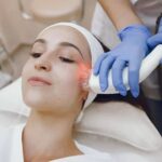 Laser Skin Resurfacing