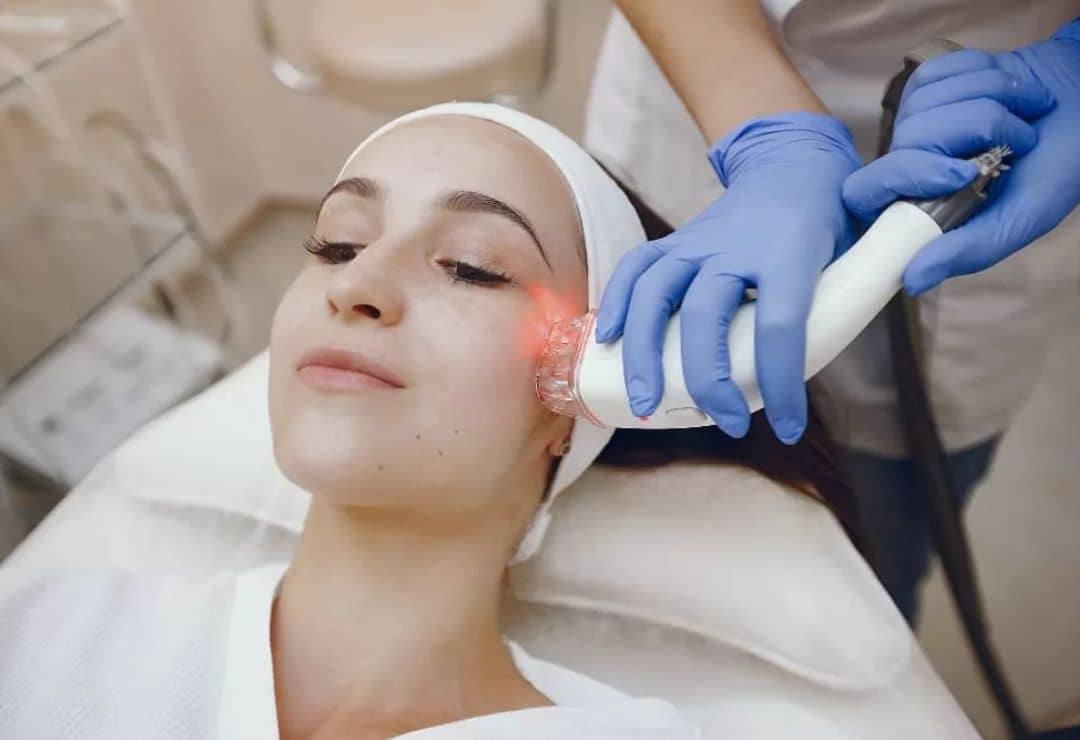 Laser Skin Resurfacing