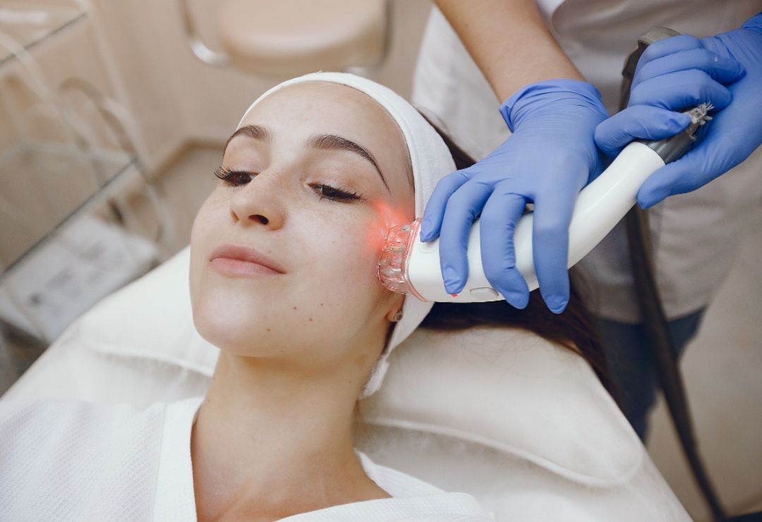 Laser Skin Tightening