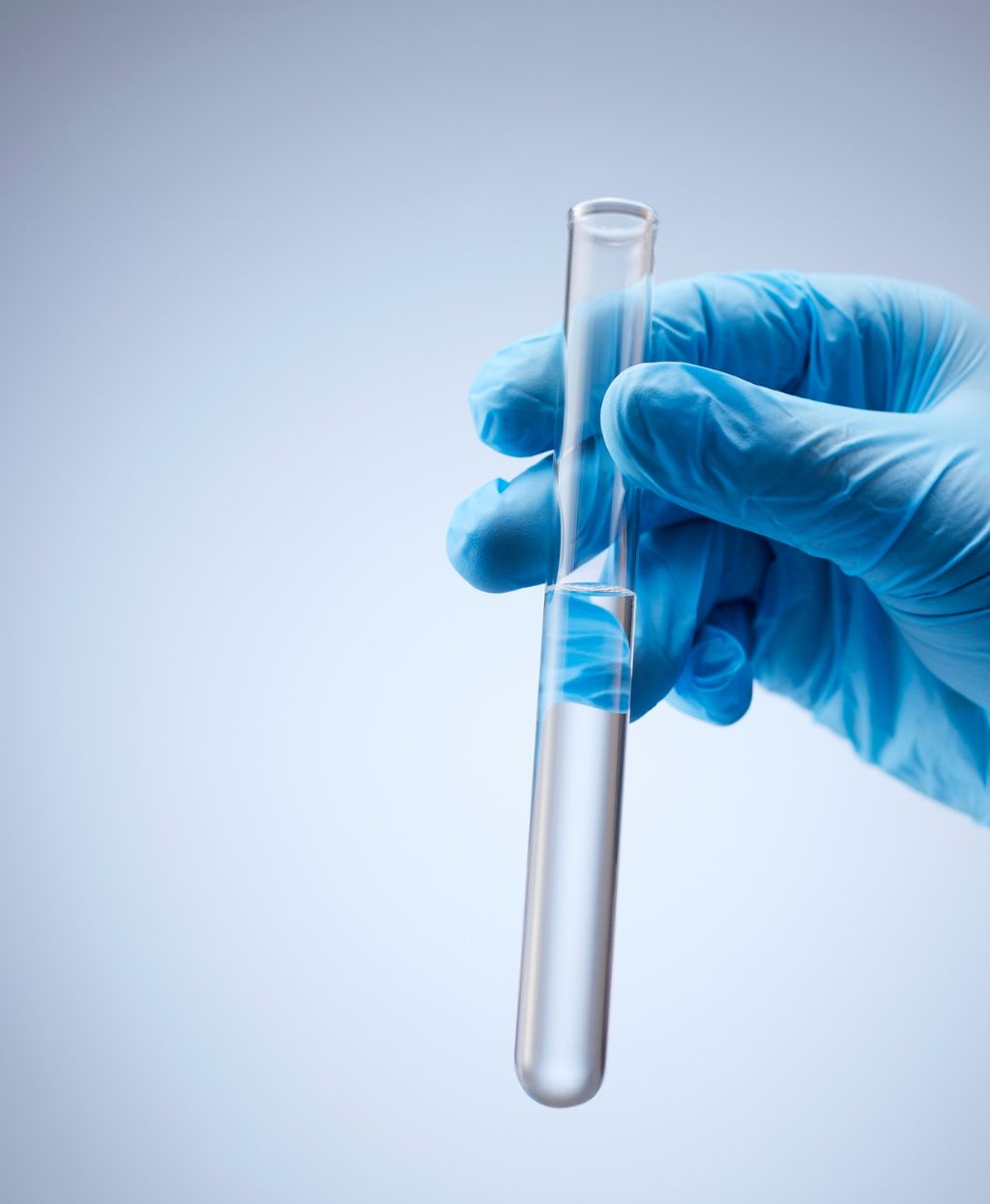 Routine Lab Tests At Home - Dynasty Clinic