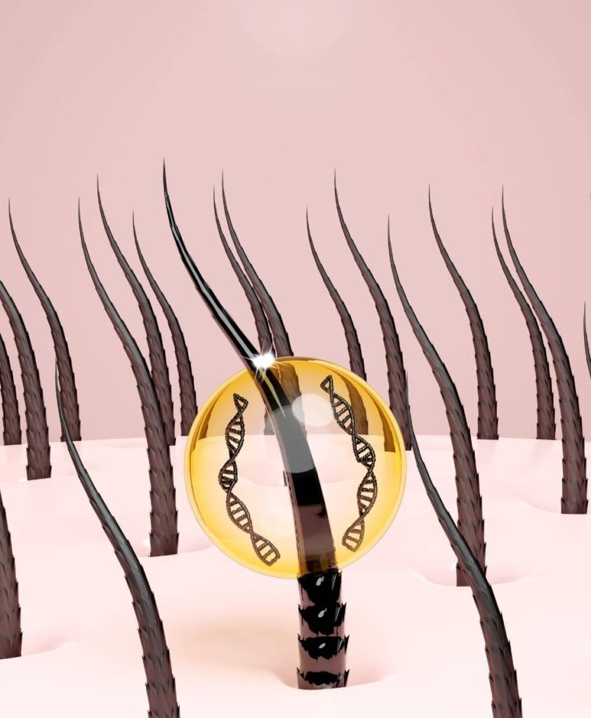 Stem Cell Hair Treatment Dubai