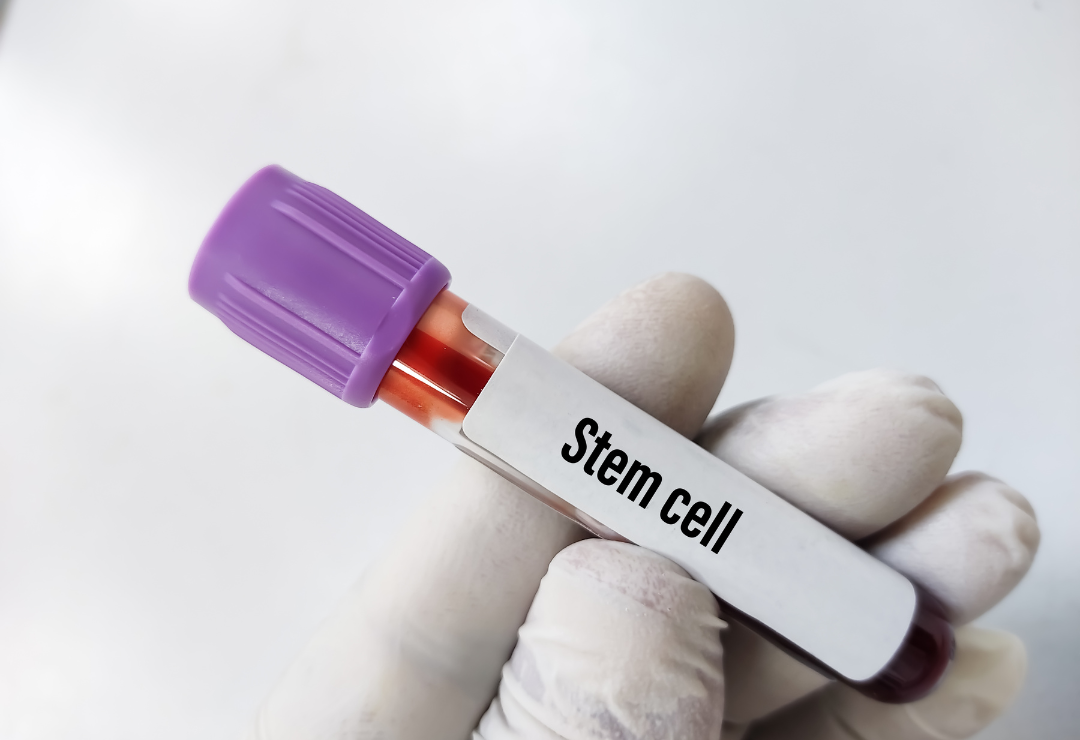 Stem Cell Solutions