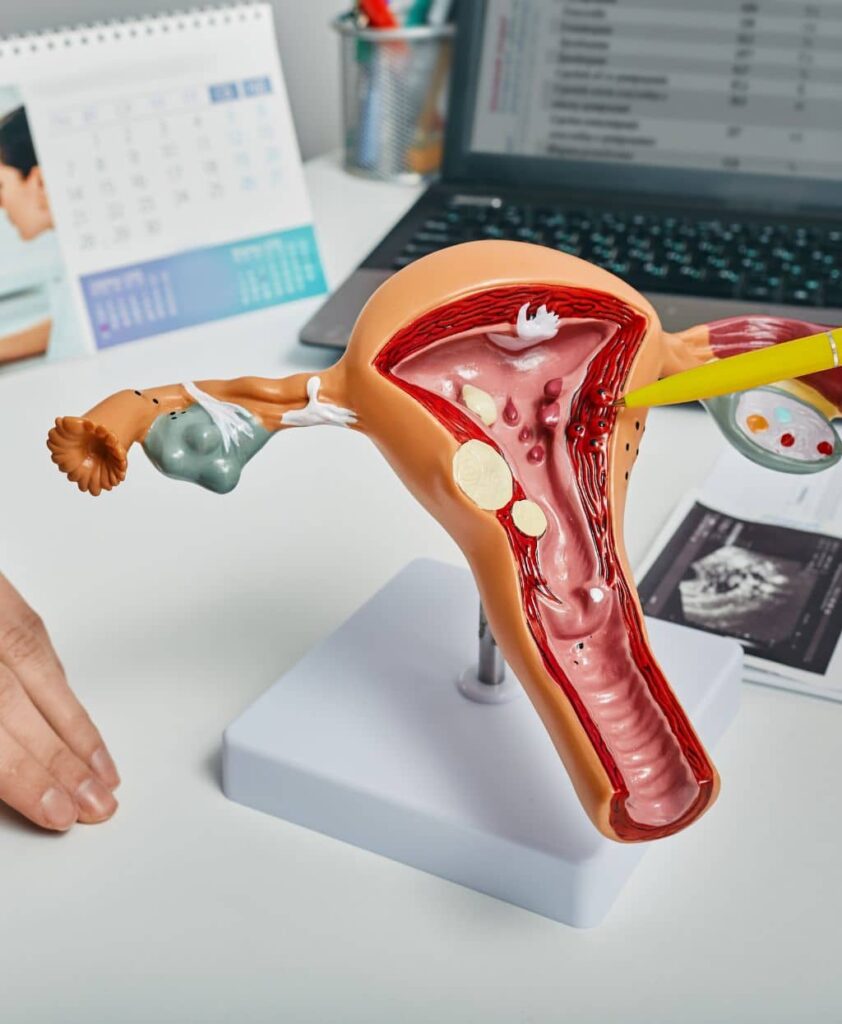 Vagina Tightening Treatment