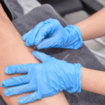 What Is Dry Needling