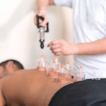 cupping therapy