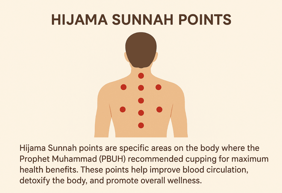 hijama sunnah pints