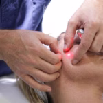 leading Endolift Clinic in Dubai