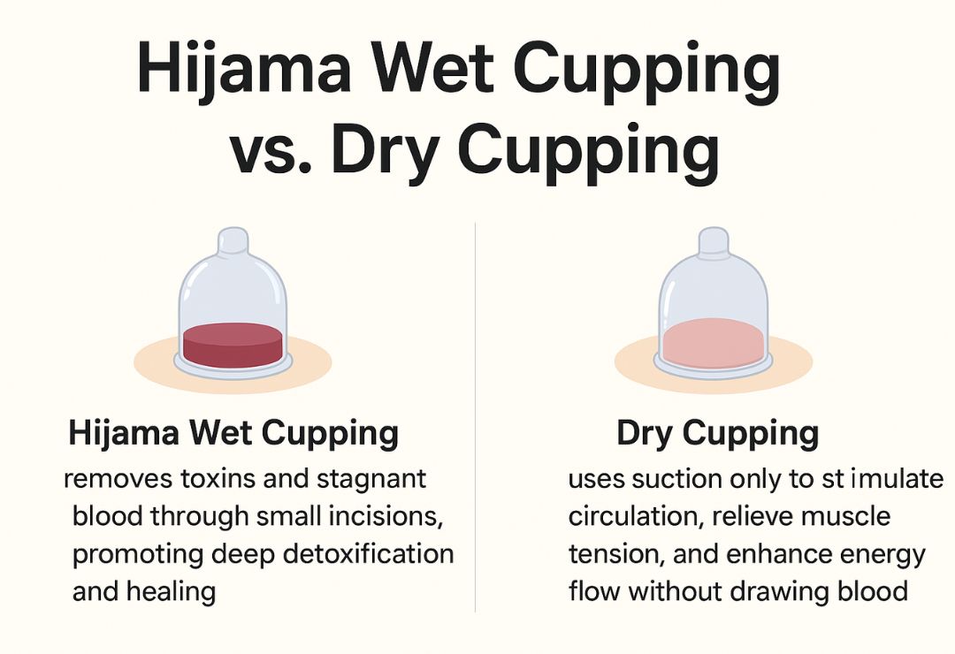 wet and dry cupping