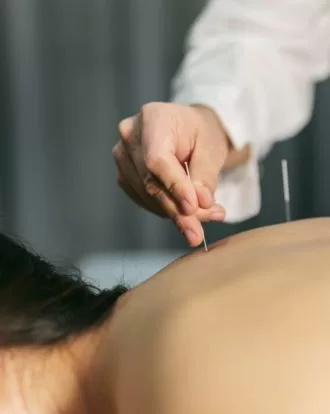 Dry Needling Therapy