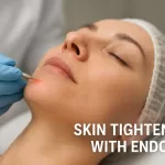Endolift