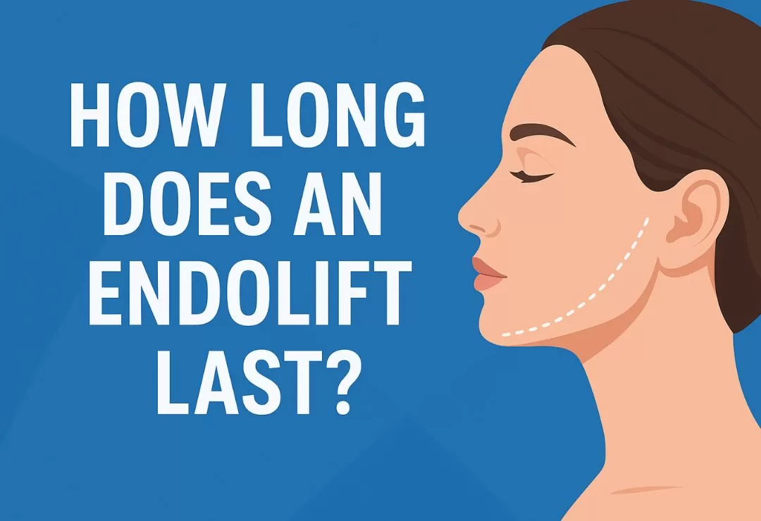 Endolift