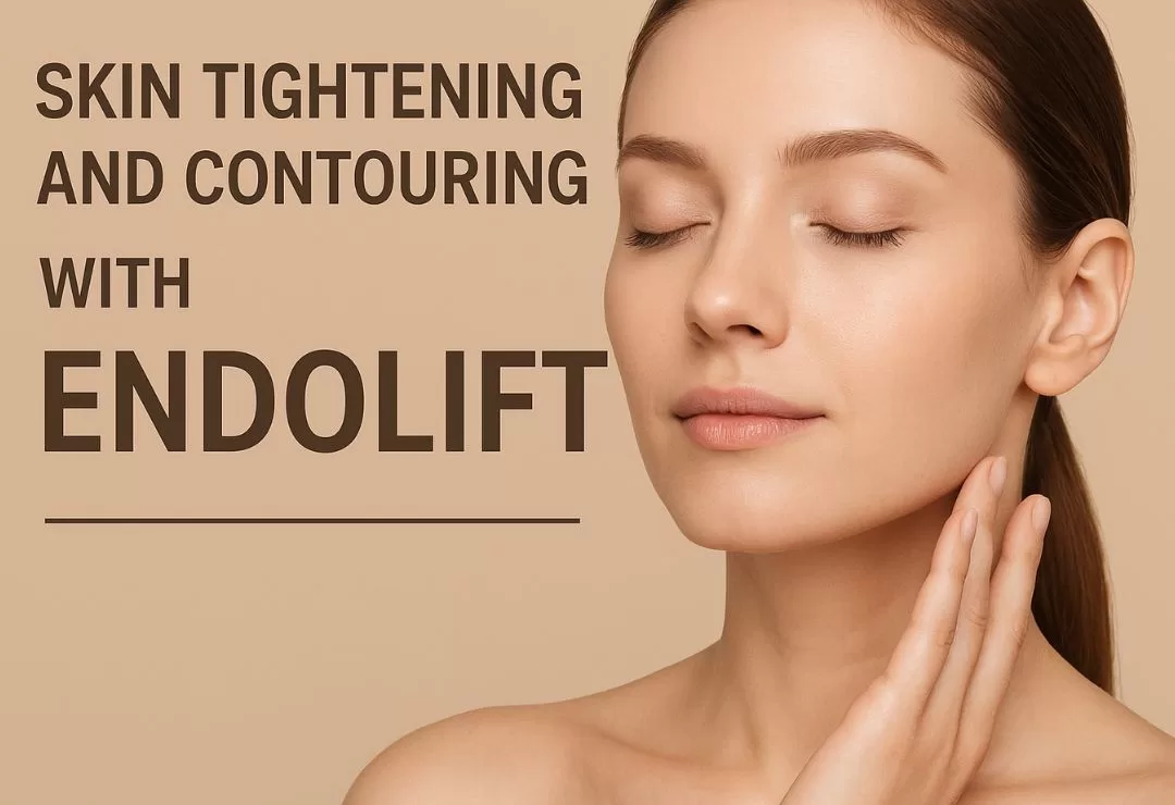 Endolift