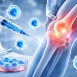 Stem Cell Therapy