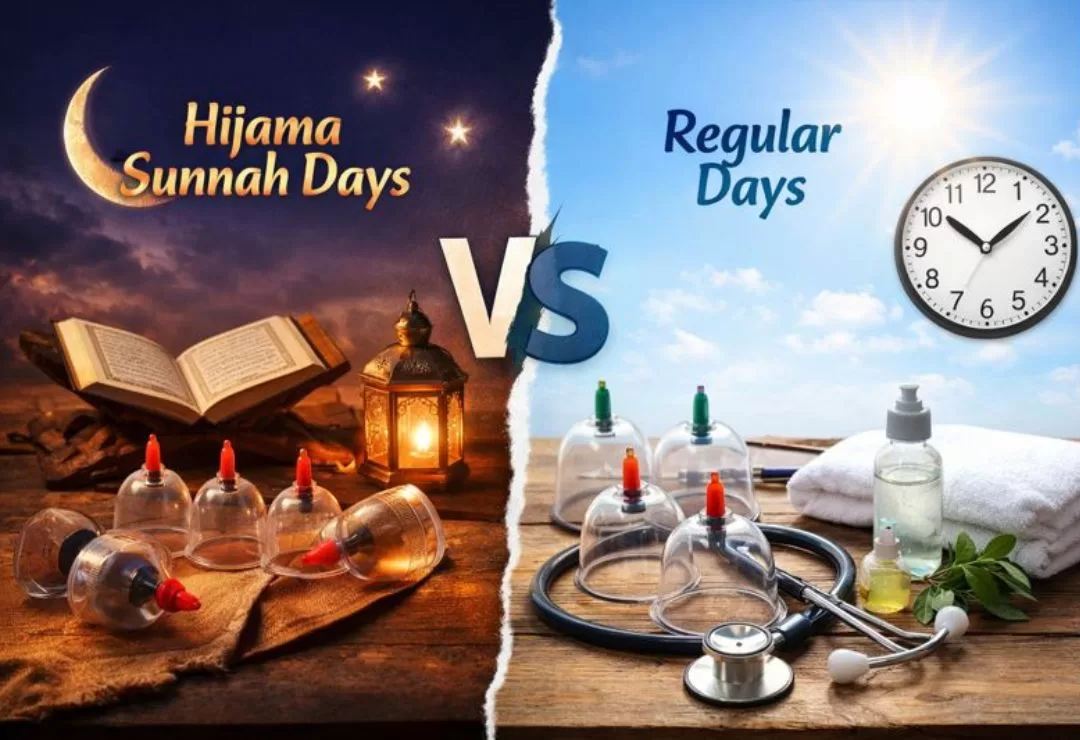 Hijama Sunnah Days