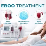 EBOO Treatment Dubai