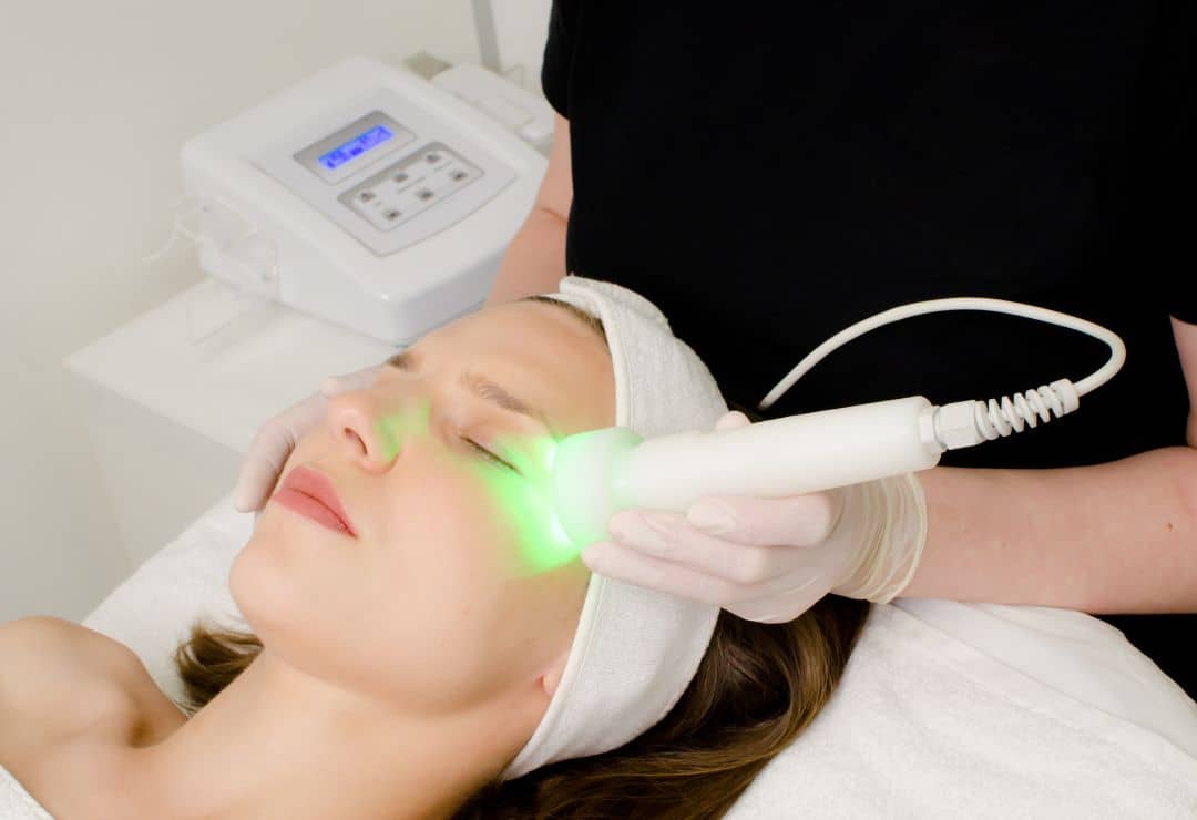 CO2 Laser Treatment