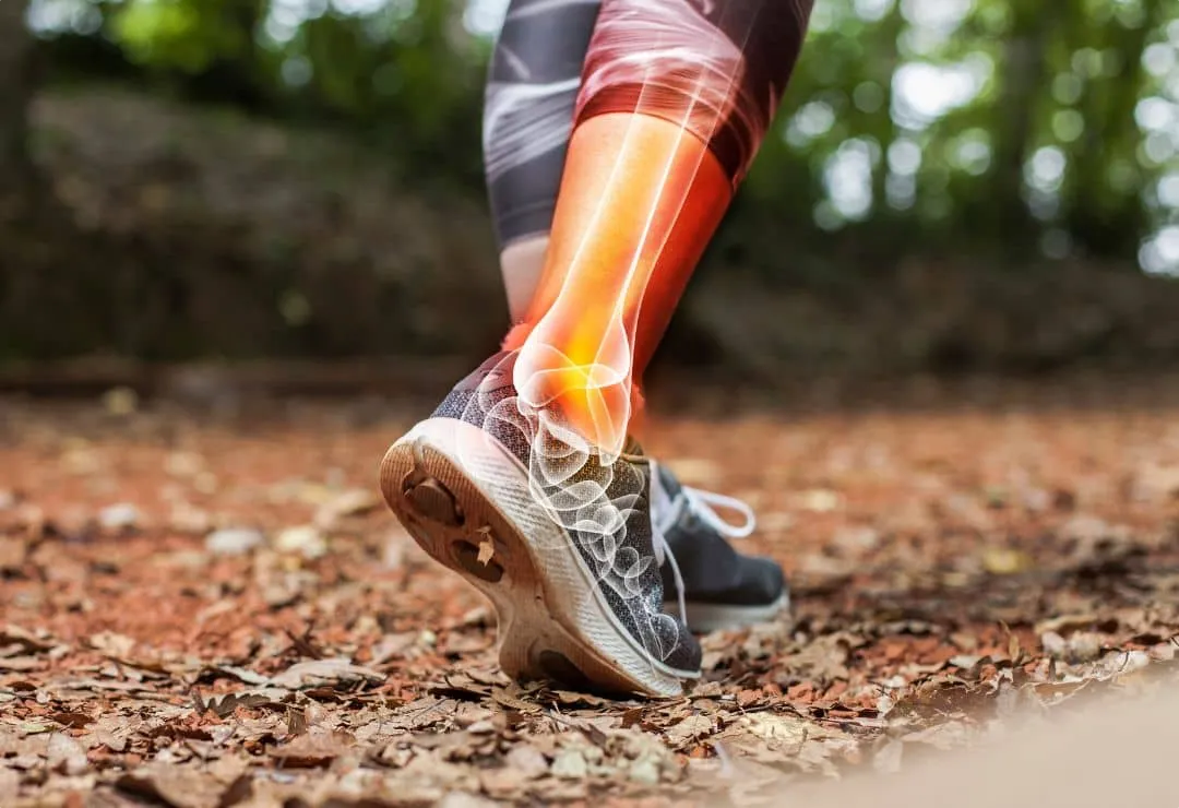 Sports Injury Recovery Timeline