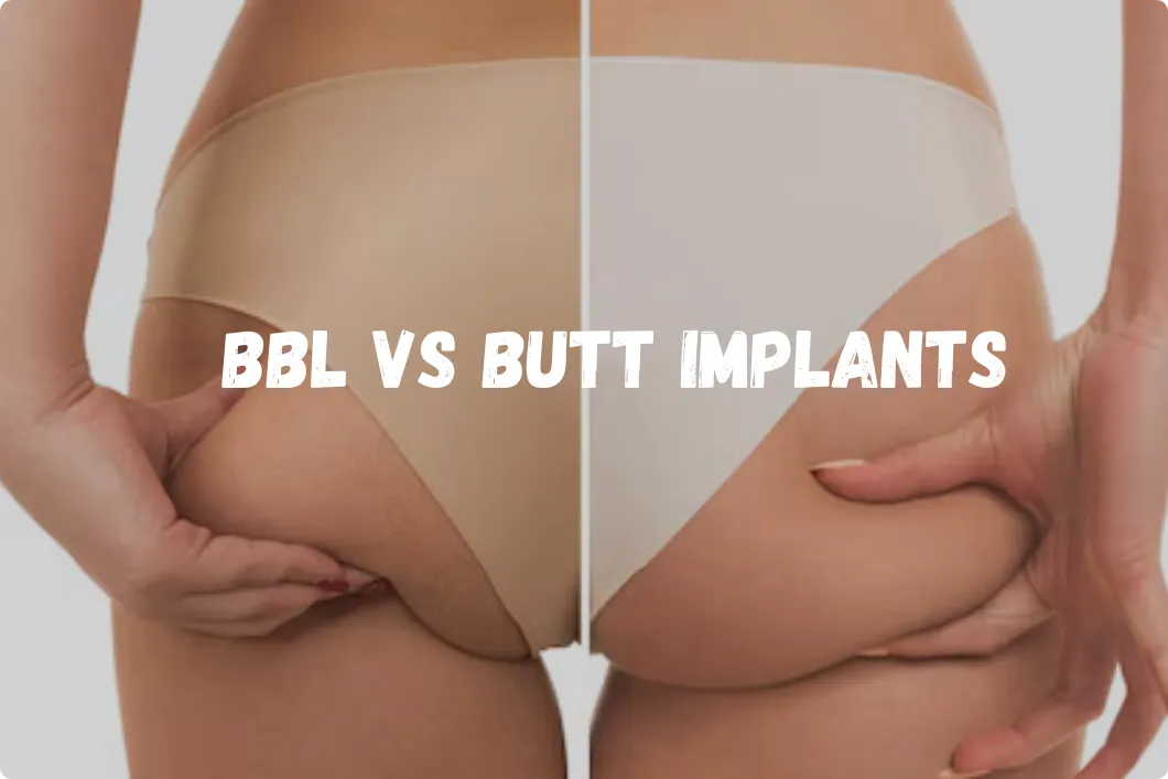 BBL vs butt implants