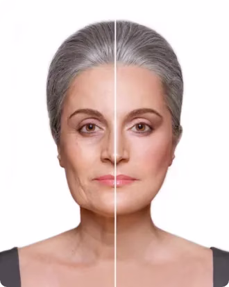 Best Endolift Doctor in Dubai