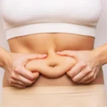 Full Tummy Tuck Recovery