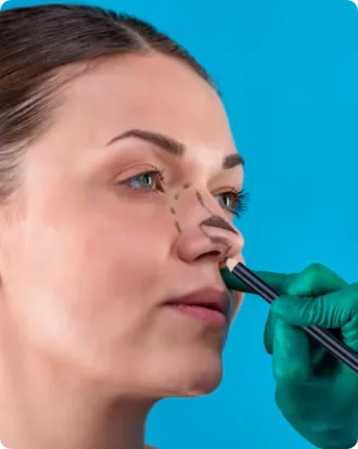 Types of Rhinoplasty