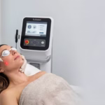 How Long Does an Endolift Last