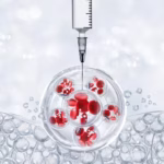 Top 10 Most Popular Stem Cell Treatments