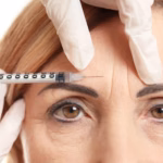 Botox for Forehead Lines