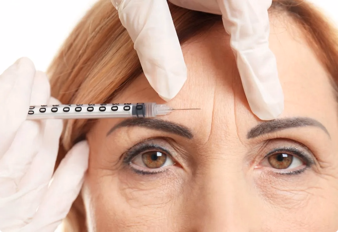 Botox for Forehead Lines