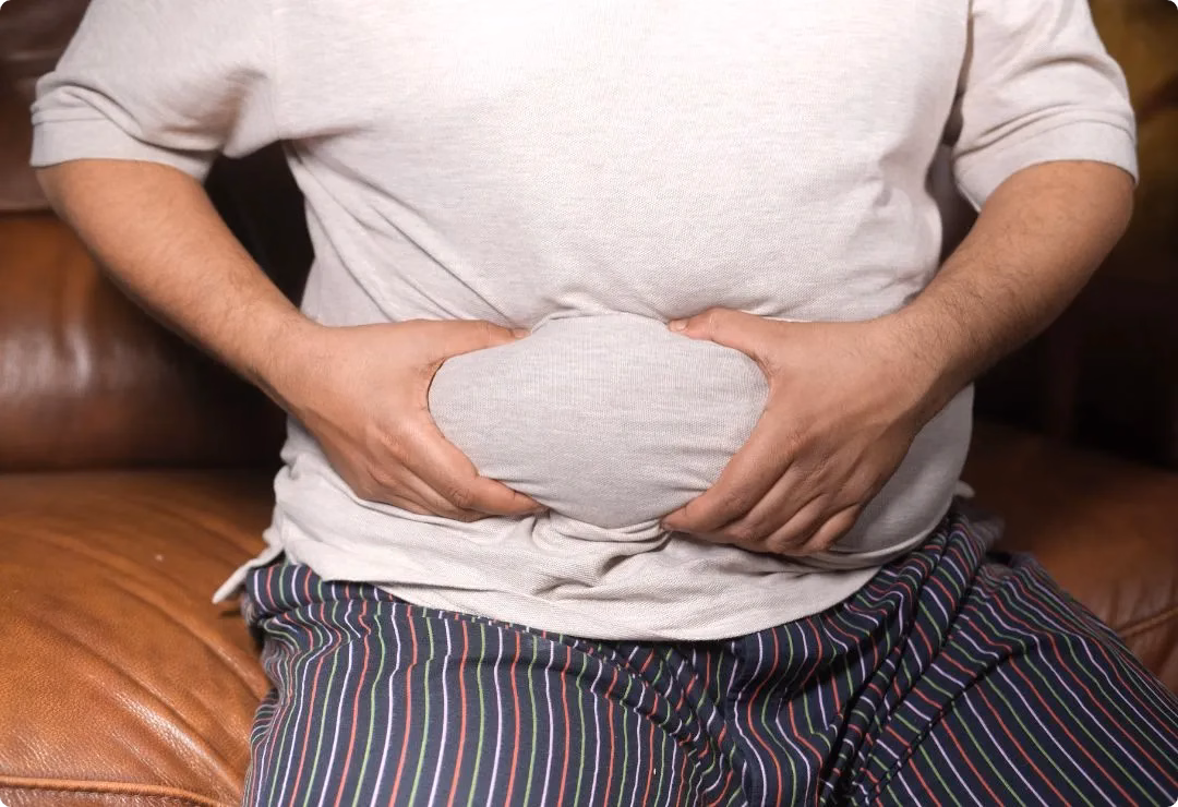 Endolift for tummy