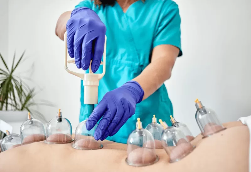 Blood Cupping Therapy
