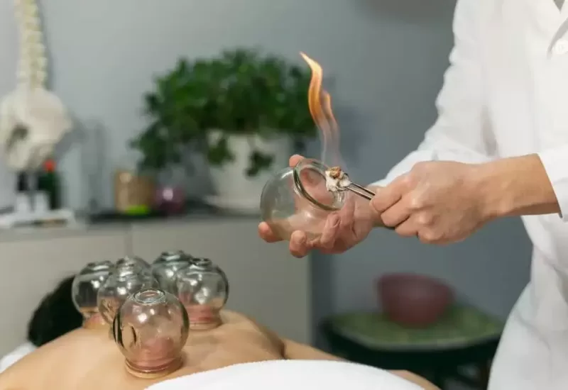 Dry Cupping Therapy