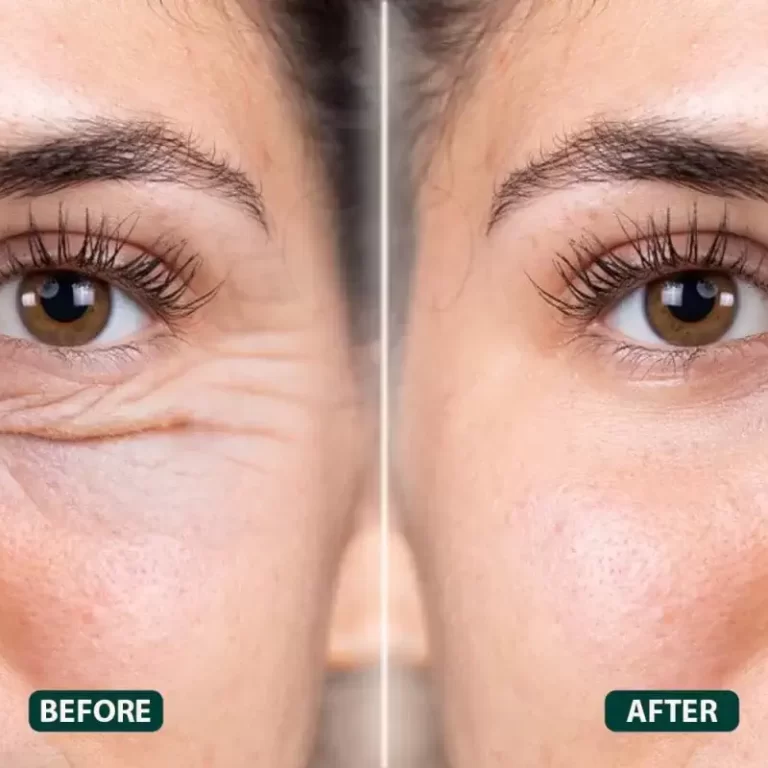 Eyebrow-Lift-Surgery-1-1200x800 (1)