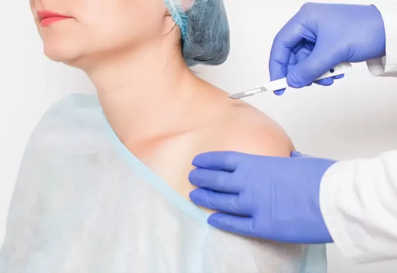 Shoulder Replacement Surgery