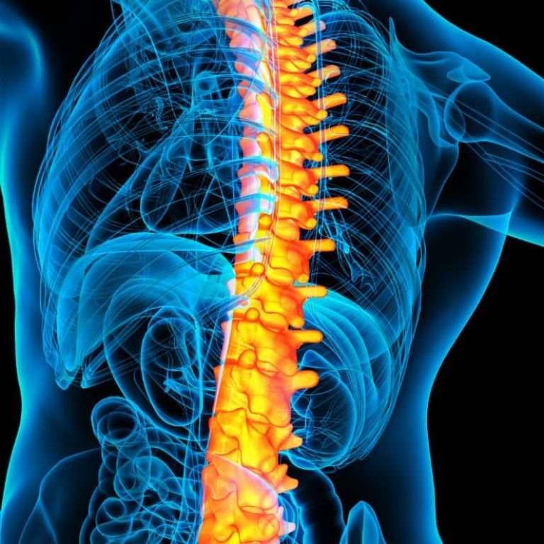 Spine Surgery in Dubai